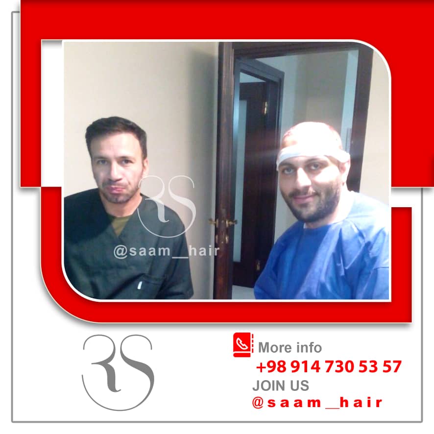 خدمات کاشت مو طبیعی سمائی